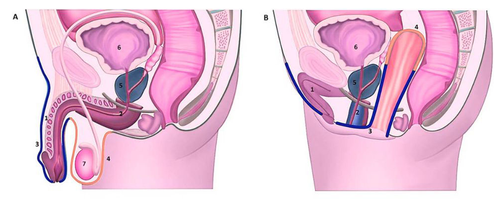 Penile